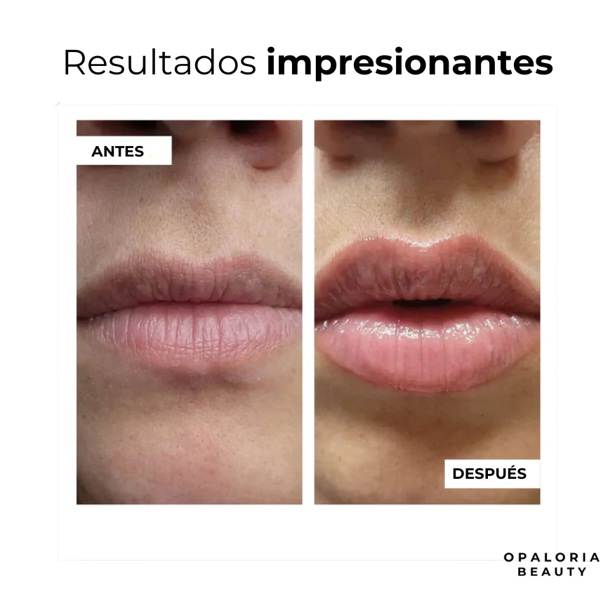 VoluLips- kit profesional voluminizador de labios. ®