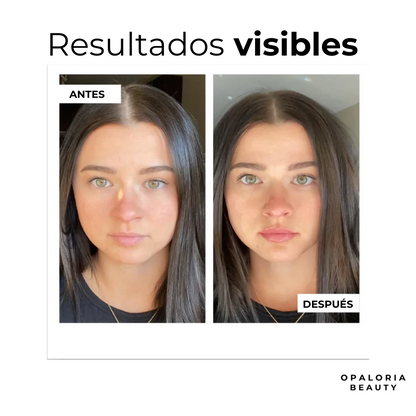 Sérum de Ácido Hialurónico